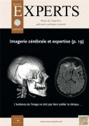 Imagerie cérébrale et expertise